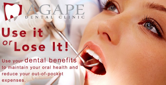 use it or lose it! Use your dental benefits to maintain your oral health