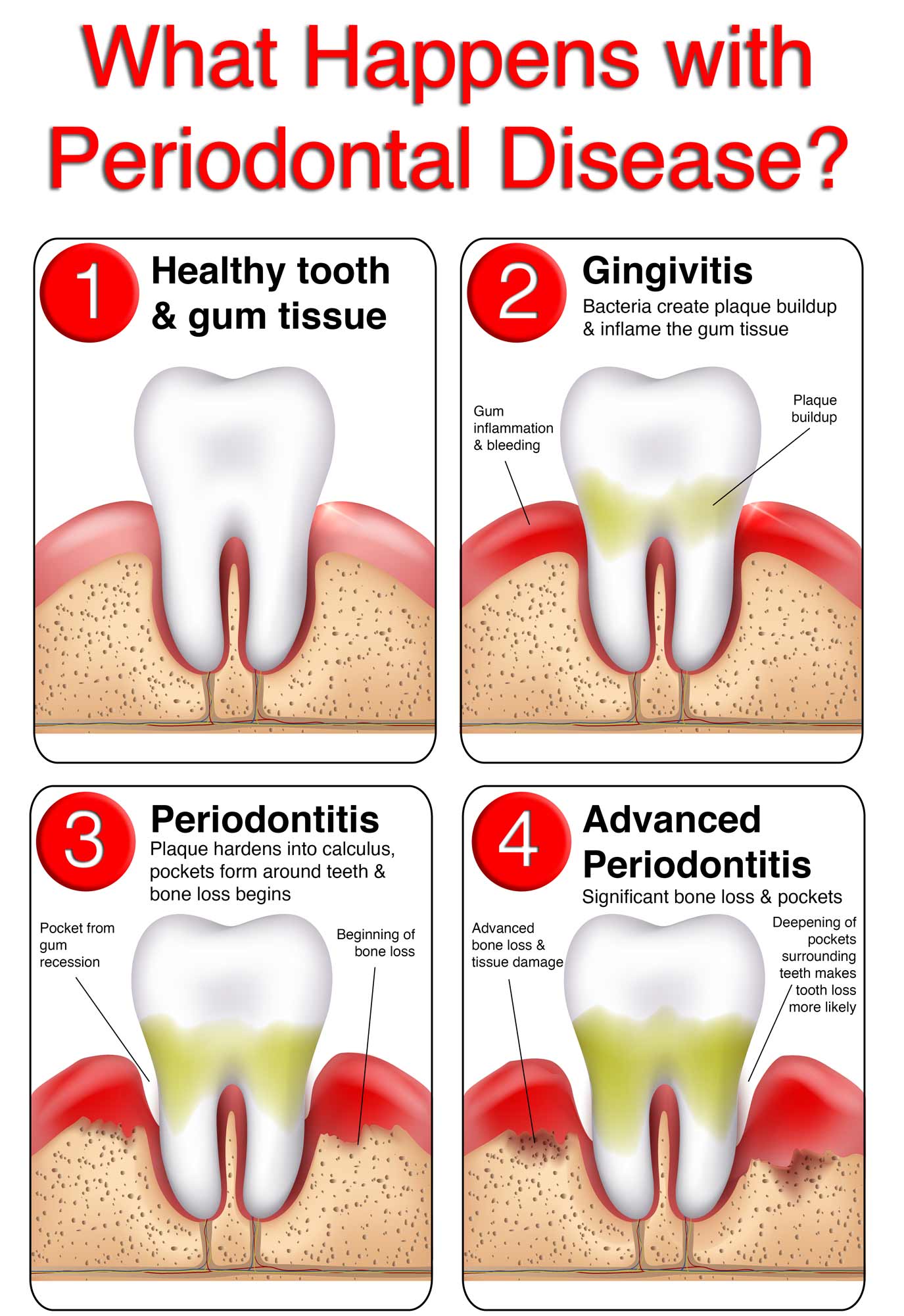 the importance of periodontal health