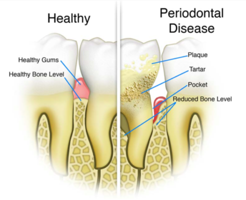 why periodontal health matters 