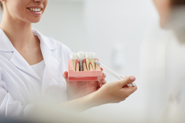 can dental implants be replaced