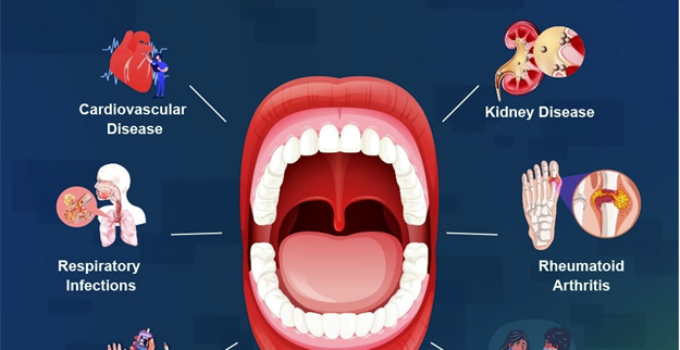 the surprising link between oral health and systemic disease